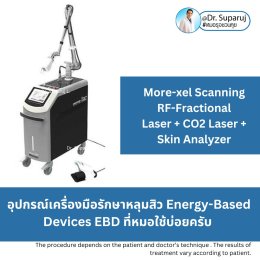 Update Energy-based Devices EBD อุปกรณ์เครื่องมือ ที่มีให้การดูแลรักษา ปัญหาผิว หลุมสิว ผมร่วงผมบาง แผลเป็น ขนคุดครับ (Update November 2023)