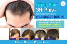 Triple Hair 3H Plus ดูแลผมร่วงผมบาง ครบด้วย เลเซอร์ l สะกิดตัวยา | ผลักวิตามิน | ฉายแสง