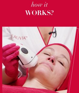 Update นวัตกรรมเลเซอร์ใหม่ล่าสุด LASER ME by NEAUVIA: Fractional Non Ablative Diode Laser: 1470 nm ช่วยดูแลปัญหาหลุมสิว ริ้วรอย แผลเป็น รูขุมขน