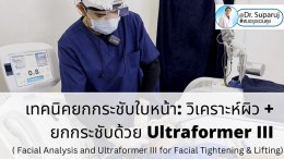 แนะนำเทคนิคยกกระชับใบหน้า: วิเคราะห์ผิว +ยกกระชับด้วย Ultraformer III ( Facial Analysis and Ultraformer III for Facial Tightening & Lifting)