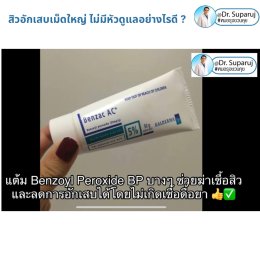 มีสิวอักเสบเม็ดใหญ่ ไม่มีหัว ขึ้น ดูแลอย่างไรดี ?