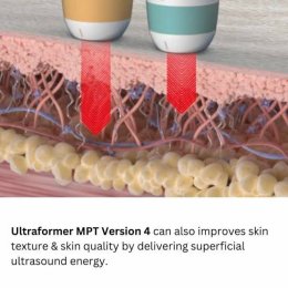 แนะนำนวัตกรรมยกกระชับผิวด้วยพลังงานคลื่นเสียง Hyperthermia Lifting Therapy: Ultraformer MPT Micro-Pulse Technology