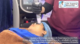 Update นวัตกรรมพลาสมารักษาสิวใหม่ล่าสุด ผ่าน US FDA: PLADUO Dual Gas Plasma System ช่วยรักษาสิว + ฆ่าเชื้อสิว C. acnes + รักษาหลุมสิว รอยดำ รอยแดง