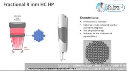 แนะนำเทคนิคดูแลปานน้ำตาล ด้วยเลเซอร์เทคนิค Fractional Pigment Toning FPT Discovery Picosecond Laser + Fractional 9 mm HC HP Handpiece