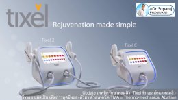 Update เทคนิครักษาหลุมสิว: Tixel ทิ๊กเซลล์ รักษาหลุมสิว ริ้วรอย แผลเป็น เพิ่มการดูดซึมยาด้วยเทคนิค TMA = Thermo-mechanical Abaltion