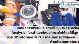  เทคนิคการประเมินวิเคราะห์ปัญหาผิว (Facial Analysis) ใบหน้าแบบไหนยกกระชับได้ผลดีที่สุด ด้วย Ultraformer MPT + เทคนิคการยิงพลังงาน + ตัวอย่างผลการรักษา