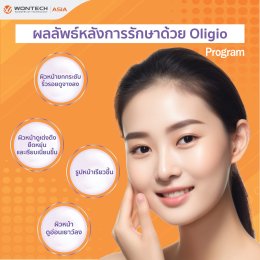 คำถามยอดฮิต นวัตกรรมกระชับผิวโปรแกรม Oligio