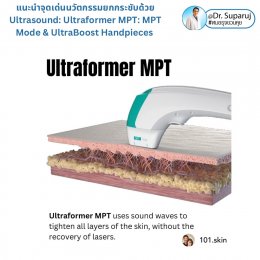 แนะนำนวัตกรรม พลังงานเครื่องเสียง Macro & Micro Focused Ultrasound ยกกระชับผิว Ultraformer MPT: จุดเด่น + ทดสอบลักษณะพลังงาน + การประเมินลักษณะผิว ให้เห็นกันชัดๆเลยครับ