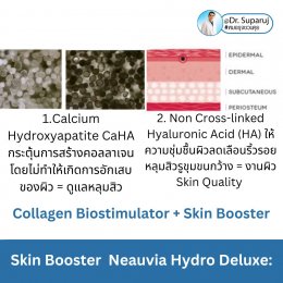 Update Skin Booster ตัวใหม่ Neauvia Hydro Deluxe: Calcium Hydroxyapatite CaHA สร้างคอลลาเจนหลุมสิว Collagen Biostimulator + Non Cross-linked Hyaluronic Acid (HA) ให้ความชุ่มชื้นผิว Skin Booster ครับ