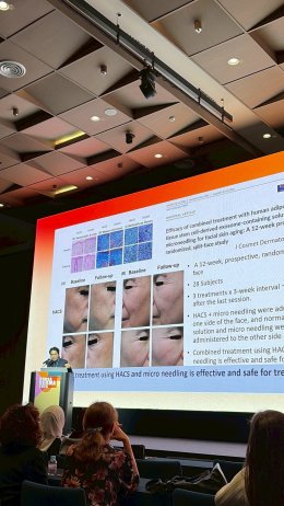 Novel Pigmentary Disorder Management at Korea Derma 2025 in Seoul Korea