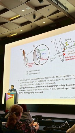 Novel Pigmentary Disorder Management at Korea Derma 2025 in Seoul Korea
