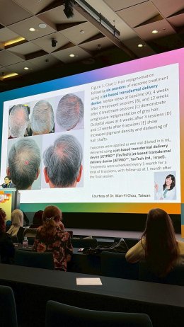 Novel Pigmentary Disorder Management at Korea Derma 2025 in Seoul Korea