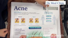 สิว เกิดจากอะไร & ดูแลรักษาได้อย่างไร ?