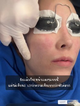 ขอบคุณคุณจูน @jirasuri มากนะครับที่ไว้วางใจให้หมอได้ดูแลปัญหาเรื่องรูขุมขนและจุดด่างดำด้วย โปรแกรม LaserME ครับผม