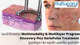 แนะนำโปรแกรม Multimodality & Multilayer Program Discovery Pico VarioPulse Treatment ดูแลปัญหาผิว หลุมสิว แผลเป็น จุดด่างดำ