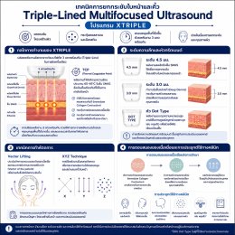 เทคนิคการยกกระชับใบหน้าและคิ้วด้วย Triple-Lined Multifocused Ultrasound: โปรแกรม X-Triple
