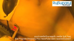แนะนำเทคนิครักษาหลุมสิว เทคนิค Soft Peel ด้วย Program Discovery Pico VarioPulse ลดความแดงหลังเลเซอร์
