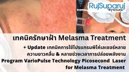 Update เทคนิคดูแลปัญหาฝ้า Melasma Treatment Update
