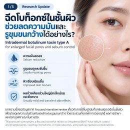 งานวิจัยทบทวน: การฉีด Botulinum Toxin Type A ในชั้นผิวเพื่อช่วยลดความมันและรูขุมขนกว้าง