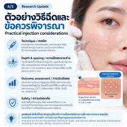 งานวิจัยทบทวน: การฉีด Botulinum Toxin Type A ในชั้นผิวเพื่อช่วยลดความมันและรูขุมขนกว้าง