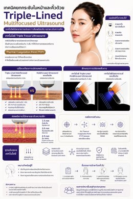 เทคนิค ยกกระชับใบหน้าและคิ้วด้วย เทคนิค Triple-Lined Multifocused Ultrasound