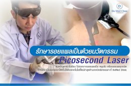 รักษารอยแผลเป็นด้วยนวัตกรรม Picosecond Laser หมดปัญหาผิวไม่เรียบ ไม่สวยจากรอยแผลเป็น หลุมสิว หรือรอยแผลทุกชนิด