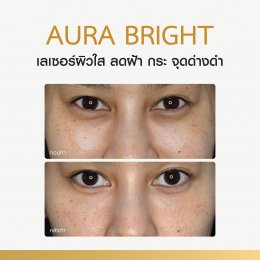 Review Aura Bright