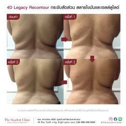 Review 4D Legacy Recontour