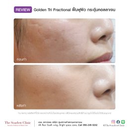 Review Golden Tri Fractional