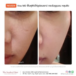 Review Viva Skin Retouch