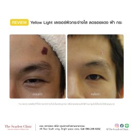 Review Yellow Light
