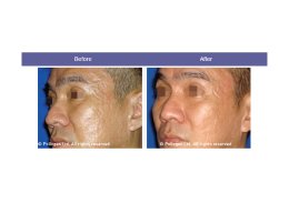 Golden Tri Fractional