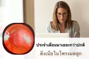 โรคติ่งเนื้อในโพรงมดลูก มาแบบไม่รู้ตัว