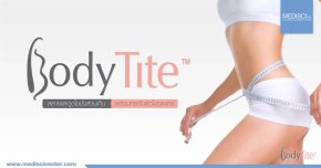 Body_Tite_Banner1