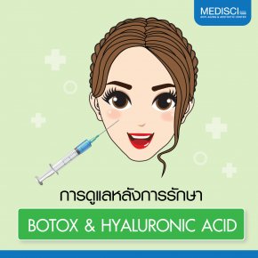 วิธีดูแลหลังการรักษาฉีด Botox-Hyaluronic Acid
