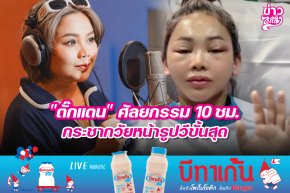 "ตั๊กแตน" ศัลยกรรม 10 ซม. กระชากวัยหน้ารูปวีขั้นสุด