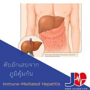 Immune hepatitis