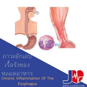 chronic inflammation of the esophagus