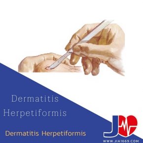 Dermatitis herpetiformis โรคตุ่มน้ำใส