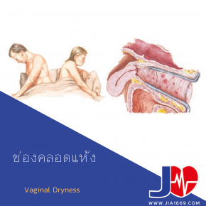Vaginal Dryness 