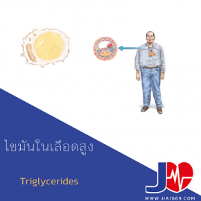 Triglycerides 
