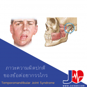 Temporomandibular Joint Syndrome