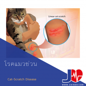 Cat-Scratch Disease 