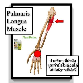 Palmaris Longus Muscle และอาการปวดร้าวบริเวณกลางฝ่ามือ แต่ไม่ลามไปถึงนิ้วมือ