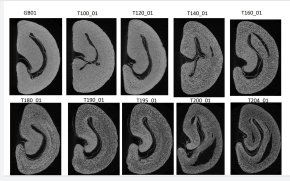 X-ray Tomography เปิดมิติใหม่ในการวิเคราะห์กาแฟ