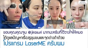 ขอบคุณคุณจูน @jirasuri มากนะครับที่ไว้วางใจให้หมอได้ดูแลปัญหาเรื่องรูขุมขนและจุดด่างดำด้วย โปรแกรม LaserME ครับผม