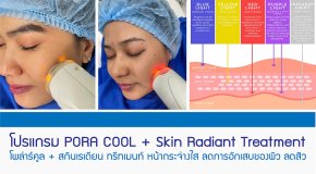 โปรแกรม PORA COOL + Skin Radiant Treatment โพล่าร์คูล + สกินเรเดียน ทรีทเมนท์ หน้ากระจ่างใส ลดการอักเสบของผิว ลดสิว