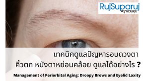 เทคนิคการรักษาปัญหารอบดวงตา: คิ้วตก หนังตาหย่อน และริ้วรอย (Periorbital Aging Management)