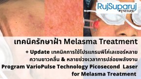 Update เทคนิคดูแลปัญหาฝ้า Melasma Treatment Update