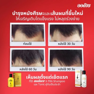 แชมพูลดผมร่วง ออด๊าซ เอ็กซ์ทร้า 200 มล